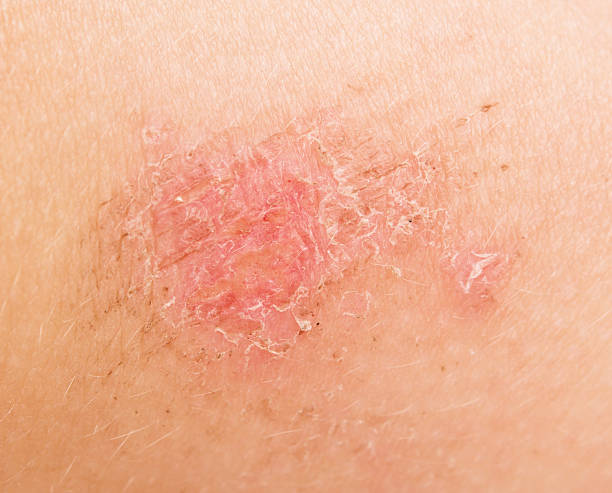 Exploring Slough Tissue Images: A Visual Guide